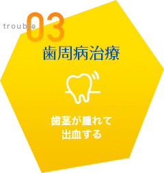歯周病治療 歯茎が腫れて 出血する